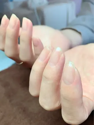 ネイル 美容爪クリニックサロン所属・美容爪 クリニックサロンのネイルデザイン