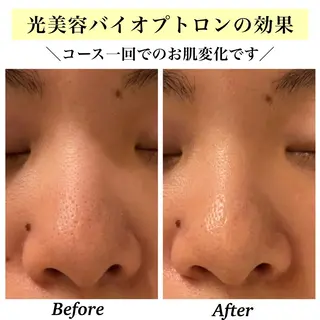 Bellesthe （ベルエステ）のエステ・リラクイメージ