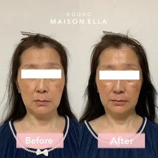 小顔　MAISON ELLAのエステ・リラクイメージ