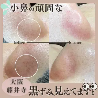 Muqu.所属・Muqu. 毛穴サロンのエステ・リラクイメージ