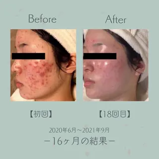 エステ＆美肌脱毛 ココサロ倉敷店のエステ・リラクイメージ