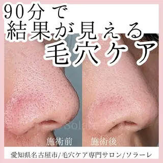  毛穴洗浄・まつ毛 の専門店 ソラーレのエステ・リラクイメージ