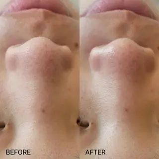 サロンドフララ 表参道店のエステ・リラクイメージ