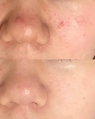 触れたくなる モテ肌へ...❤︎のエステ・リラクイメージ