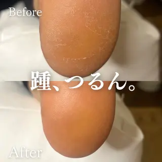 Foot Care Salon Coco 拝島店所属・Foot Salon -Coco-拝島店のエステ・リラクイメージ