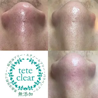 セルフエステエンリケ明石大久保店所属・夕希 毛穴と脱毛特化サロンのエステ・リラクイメージ