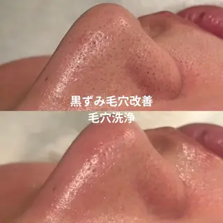 【LEPUS】レプス nishimoriのエステ・リラクイメージ