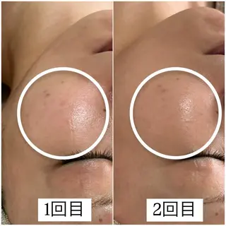 1st｜フェイシャル エステ専門店のエステ・リラクイメージ