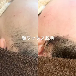 EST BEAUTY所属・顔ワックス脱毛/ ハーブピーリングのエステ・リラクイメージ