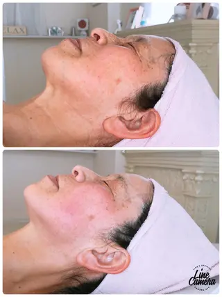 Lupine （エステティシャン）のエステ・リラクイメージ