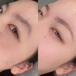 アイブロウ 脱毛サロン　HUGME.所属・脱毛サロンHUGME 光フォトフェイシャルのエステ・リラクイメージ