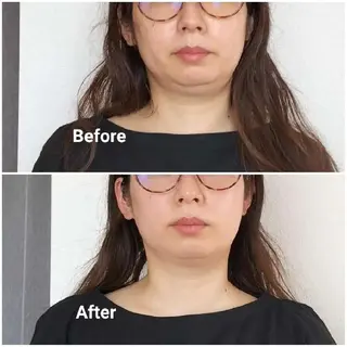 美容矯正 ＱＵＩＣＯ【キコ】のエステ・リラクイメージ