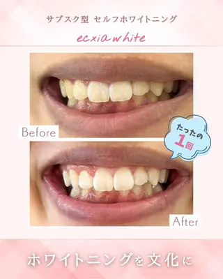 セルフホワイトニングエクシア天王寺店所属・セルフホワイトニング エクシア大阪天王寺店のその他イメージ