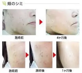 M渋谷店所属・Ｍ渋谷 ホワイトニングのエステ・リラクイメージ