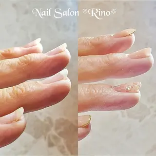 ミディアム ネイル Katayama Yokoのネイルデザイン