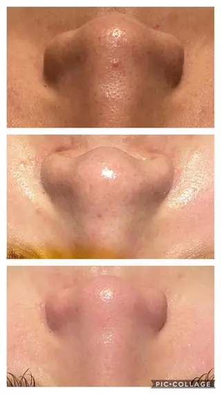 natura chuchuナトゥーラチュチュ所属・バスト体験 ナトゥーラチュチュのエステ・リラクイメージ