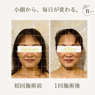 小顔サロンラヴィ　　船橋馬込沢店所属・小顔サロンラヴィ 船橋のエステ・リラクイメージ