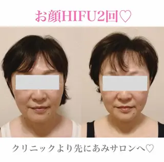 a  room salonのエステ・リラクイメージ