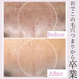 毛穴ケア専門サロンアンスリウム所属・茨城土浦 つくば毛穴 ケア専門サロンのエステ・リラクイメージ