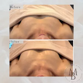 IHANA. バストケアサロンのエステ・リラクイメージ