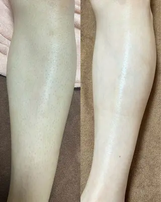 都度払い制脱毛サロンBe Charm所属・Be Charm 山﨑のエステ・リラクイメージ