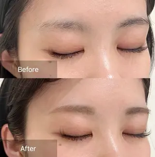 アイブロウ for woman所属・森 美優のエステ・リラクイメージ