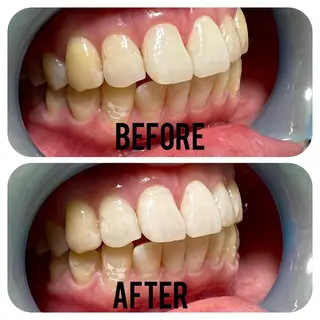 two nailのネイルデザイン