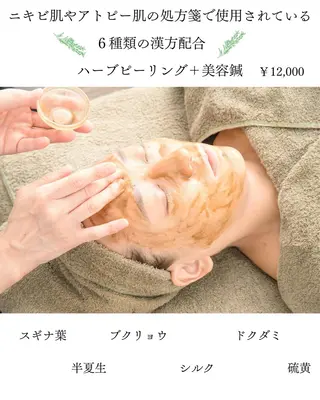 ニキビ特化美容鍼 ×ハーブピーリングのエステ・リラクイメージ