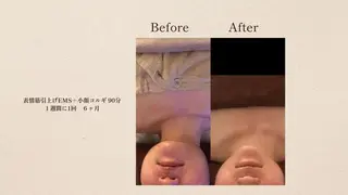 小顔コルギ＆よもぎ蒸しサロンLINKA所属・小顔＆美肌 サロンLINKAのエステ・リラクイメージ