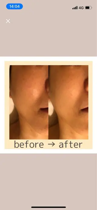 ポーラ梅田太融寺店所属・POLA 梅田太融寺店のエステ・リラクイメージ