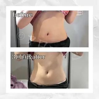 部分痩せ♥️小顔専門 MIKUのエステ・リラクイメージ