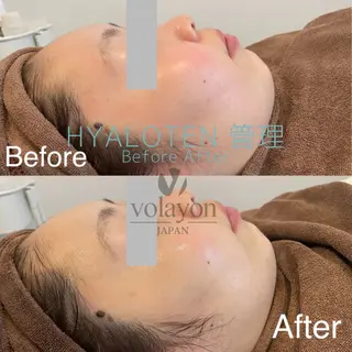 Hilluin所属・Hilluin 힐루인 韓国肌管理のエステ・リラクイメージ