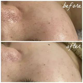 メンズ メナード岐阜市茜部 杉浦のエステ・リラクイメージ