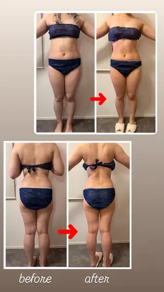 本気で痩せたい方へ 痩身専門サロンのその他イメージ