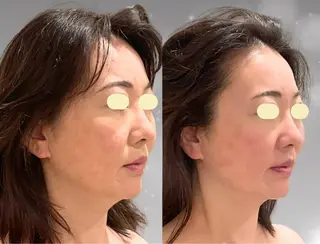 小顔/たるみ/黒ずみ除去専門サロン/SONA 大和西大寺店所属・【小顔専門看護師 サロンSONA】のエステ・リラクイメージ