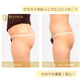 セルフ脱毛/美尻イス キングスサロン熊本のエステ・リラクイメージ