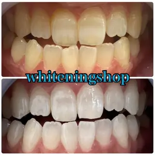 ホワイトニング ショップ吉祥寺店のエステ・リラクイメージ