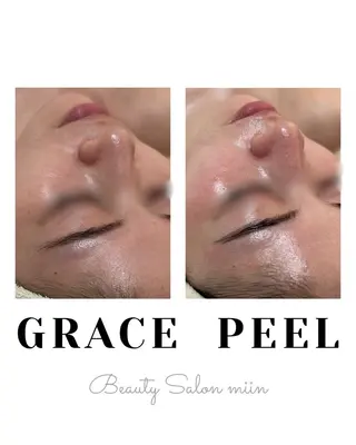 韓国肌管理 白玉肌管理®︎のエステ・リラクイメージ