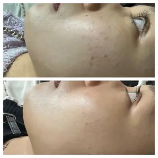 肌質改善Beauty salon Renのエステ・リラクイメージ