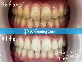 ホワイトニングカフェ荻窪店所属・ホワイトニングカフェ 荻窪店のその他イメージ