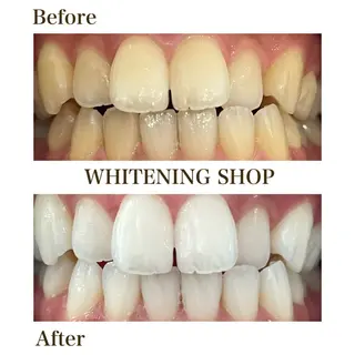 ホワイトニングショップ静岡葵区店所属・ホワイトニング ショップ静岡葵区店のその他イメージ