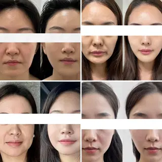 愛維美水光美肌専門店所属・愛維美水光美肌専門店 メンズレディースokのエステ・リラクイメージ