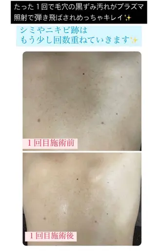 ベラージュ【美背中・ 美尻・フェイシャル】のエステ・リラクイメージ