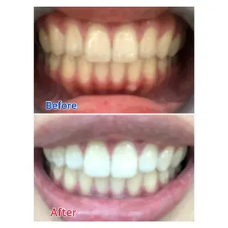 MBEAUTYSALON 千葉店・京成大久保所属・Melty 輝のその他イメージ