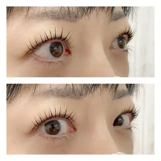 マツエク・マツパ schön所属・schön 松井のエステ・リラクイメージ