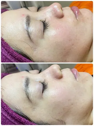 REMENTE池袋東口店所属・REMENTE🪞 KANAのエステ・リラクイメージ