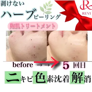 laluna saki...のその他イメージ