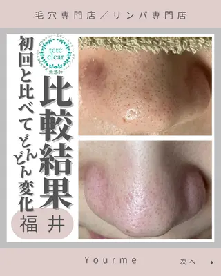 毛穴肌質ケアサロン Yourmeユアミーのエステ・リラクイメージ