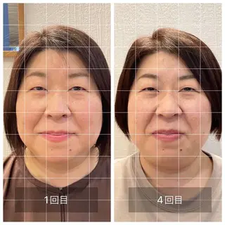 美容鍼　蒼月-aotsuki-所属・美容鍼「蒼月」 -アオツキ-のエステ・リラクイメージ