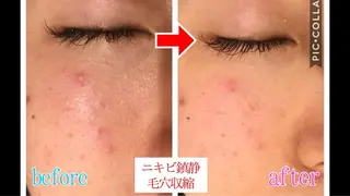 セミロング パーマ ヘアアレンジ メンズ ネイル マツエク・マツパ 四つ星サロン🎖 腸＆ニキビケアに特化のエステ・リラクイメージ